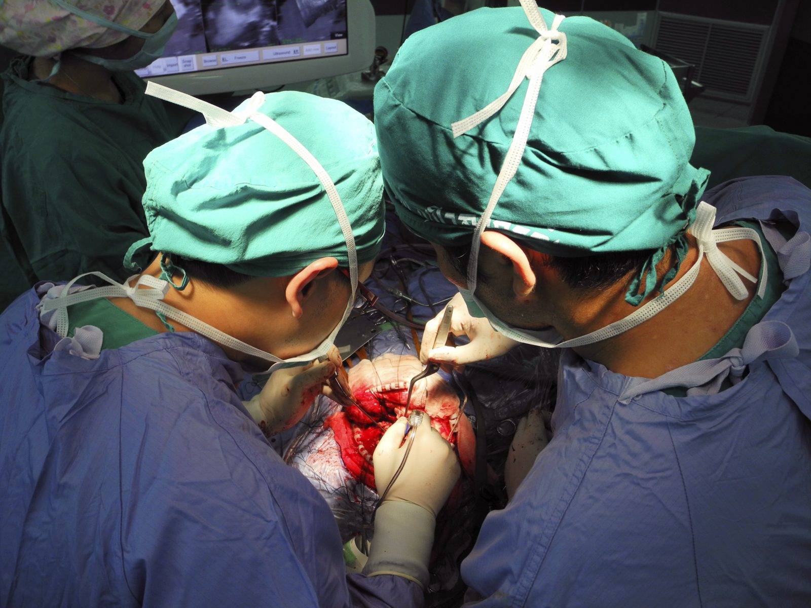 Brain Surgery Operation
